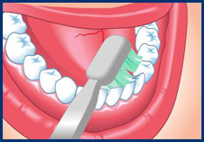 Dentiste : brossage de dents
