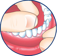 Dentiste Repentigny : soie dentaire 3